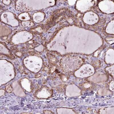 Immunohistochemistry-Paraffin: LIN7C Antibody [NBP2-14193] - Staining of human thyroid gland shows strong granular cytoplasmic positivity in glandular cells.