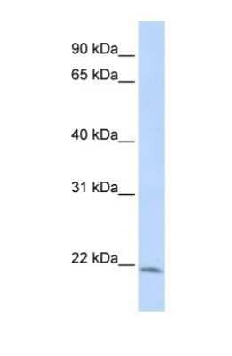 Western Blot: LIN7C Antibody [NBP1-53082] - HepG2 cell lysate, concentration 1 ug/ml.