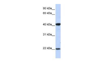 Western Blot: LIN7C Antibody [NBP2-85211] - WB Suggested Anti-LIN7C Antibody Titration: 1 ug/ml. Positive Control: MCF-7 whole cell lysatesLIN7C is supported by BioGPS gene expression data to be expressed in MCF7