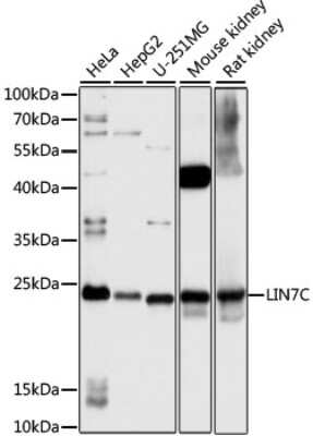 Western Blot: LIN7C Antibody [NBP3-04771] - Analysis of extracts of various cell lines, using LIN7C antibody at 1:1000 dilution. Secondary antibody: HRP Goat Anti-Rabbit IgG (H+L) at 1:10000 dilution. Lysates/proteins: 25ug per lane. Blocking buffer: 3% nonfat dry milk in TBST. Detection: ECL Basic Kit