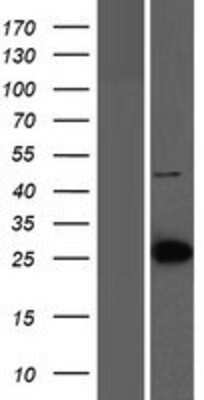 Western Blot: LIN7C Overexpression Lysate (Adult Normal) [NBP2-06816] Left-Empty vector transfected control cell lysate (HEK293 cell lysate); Right -Over-expression Lysate for LIN7C.