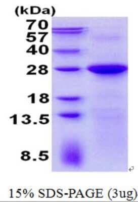 SDS-Page: LIN7C Protein [NBP2-23199]