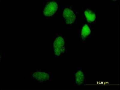 Immunocytochemistry/Immunofluorescence: LIN9 Antibody [H00286826-B01P] - Analysis of purified antibody to LIN9 on HeLa cell. (antibody concentration 10 ug/ml)