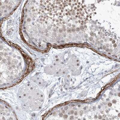 Immunohistochemistry-Paraffin: LIN9 Antibody [NBP1-80690] - Staining of human testis shows moderate nuclear positivity in Leydig cells and cells in seminiferous ducts.