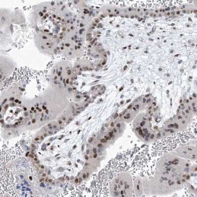 Immunohistochemistry-Paraffin: LIN9 Antibody [NBP1-80690] - Staining of human placenta shows moderate nuclear positivity in trophoblastic cells.