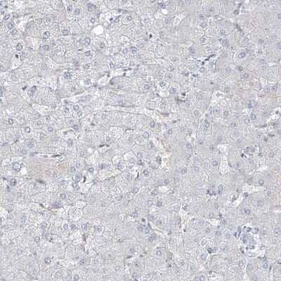 Immunohistochemistry-Paraffin: LIN9 Antibody [NBP1-80690] - Staining of human liver shows no positivity in hepatocytes as expected.