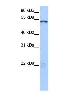 Western Blot: LIN9 Antibody [NBP1-79424] - Hela cell lysate, concentration 0.2-1 ug/ml.