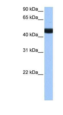 Western Blot: LIN9 Antibody [NBP1-79425] - Human Brain lysate, concentration 0.2-1 ug/ml.