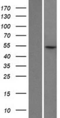 Western Blot: LIN9 Overexpression Lysate (Adult Normal) [NBP2-05151] Left-Empty vector transfected control cell lysate (HEK293 cell lysate); Right -Over-expression Lysate for LIN9.