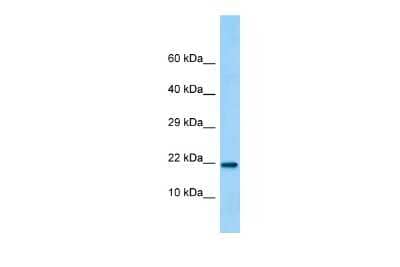 Western Blot LINC02694 Antibody - BSA Free