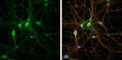 Immunocytochemistry/Immunofluorescence: LINGO-1 Antibody [NBP2-19359] - LINGO1 antibody [C1C3] detects LINGO1 protein by immunofluorescent analysis.Sample: DIV9 rat E18 primary cortical neuron cells were fixed in 4% paraformaldehyde at RT for 15 min. Green: LINGO1 stained by LINGO1 antibody [C1C3] diluted at 1:500. Red: beta Tubulin 3/ Tuj1, stained by beta Tubulin 3/ Tuj1 antibody [GT1338] diluted at 1:500. Blue: Fluoroshield with DAPI.