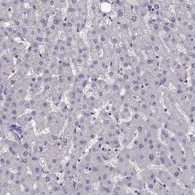 Immunohistochemistry-Paraffin: LINGO-1 Antibody [NBP2-57689] - Staining of human liver shows low expression as expected.