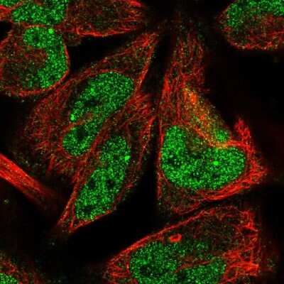 Immunocytochemistry/Immunofluorescence: LINS1 Antibody [NBP2-58628] - Staining of human cell line RH-30 shows localization to nucleoplasm.