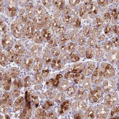 Immunohistochemistry-Paraffin: LIPJ Antibody [NBP2-14195] - Staining of human stomach, lower shows strong cytoplasmic positivity in glandular cells.