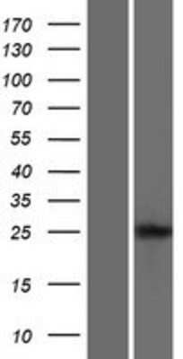 Western Blot LIPT2 Overexpression Lysate