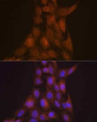 Immunocytochemistry/Immunofluorescence: LIS1 Antibody (9O6X3) [NBP3-16253] - Immunofluorescence analysis of C6 cells using LIS1 Rabbit mAb (NBP3-16253) at dilution of 1:100 (40x lens). Blue: DAPI for nuclear staining.