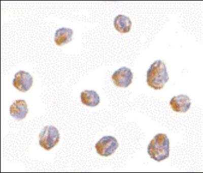 Immunocytochemistry/Immunofluorescence: LIS1 Antibody [NBP1-03125] - LIS1 in Jurkat cells with LIS1 antibody at 2.5 ug/ml.