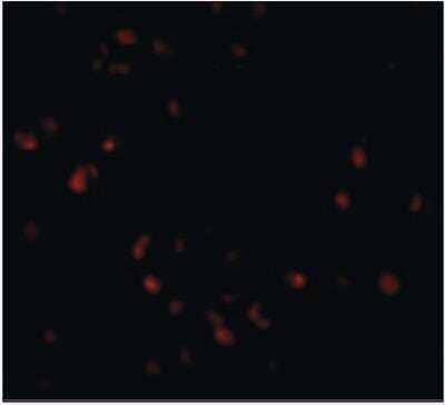 Immunocytochemistry/Immunofluorescence: LIS1 Antibody [NBP1-03125] - LIS1 in Jurkat cells with LIS1 antibody at 20 ug/ml.