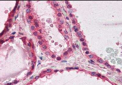 Immunohistochemistry-Paraffin: LIS1 Antibody [NB100-1040] - Staining of paraffin embedded Human Thyroid. Antibody at 3.75 ug/mL. Steamed antigen retrieval with citrate buffer pH 6, AP-staining.