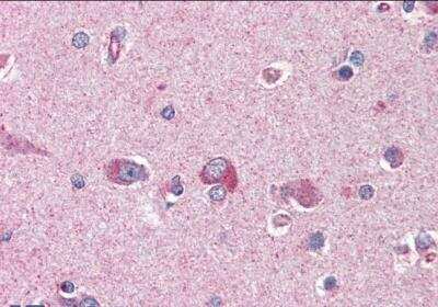 Immunohistochemistry-Paraffin: LIS1 Antibody [NB100-1040] - Staining of paraffin embedded Human Cortex. Antibody at 3.75 ug/mL. Steamed antigen retrieval with citrate buffer pH 6, AP-staining.