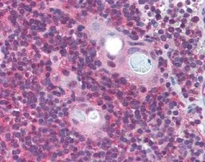 Immunohistochemistry-Paraffin: LIS1 Antibody [NBP1-03125] - Staining of human thymus. Immunohistochemistry of formalin-fixed, paraffin-embedded tissue after heat-induced antigen retrieval. Antibody concentration 5 ug/ml.