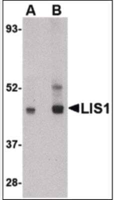 Western Blot: LIS1 Antibody [NBP1-03125] - LIS1 in HeLa cell lysate with LIS1 antibody at (A) 0.5 and (B) 1 ug/ml.
