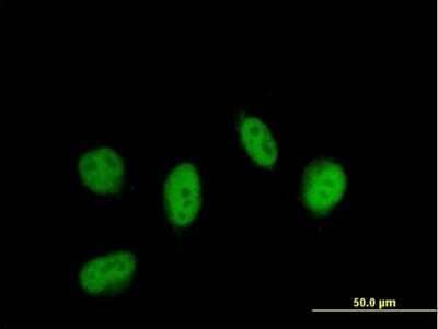 Immunocytochemistry/Immunofluorescence: LITAF Antibody [H00009516-B01P] - Analysis of purified antibody to LITAF on HeLa cell. (antibody concentration 10 ug/ml)