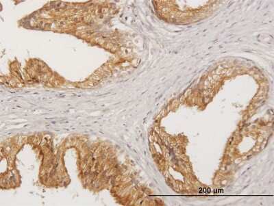 Immunohistochemistry-Paraffin: LITAF Antibody [H00009516-B01P] - Analysis of purified antibody to LITAF on formalin-fixed paraffin-embedded human prostate. (antibody concentration 3 ug/ml)
