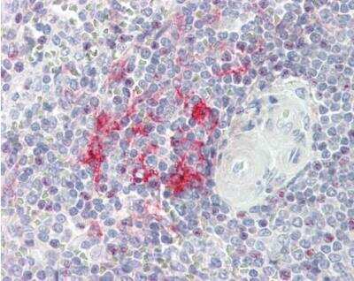 Immunohistochemistry-Paraffin: LITAF Antibody [NBP1-32726] - Paraffin-embedded placenta. LITAF antibody [N1C3]  dilution: 1:100.