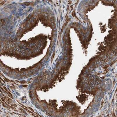 Immunohistochemistry-Paraffin: LITAF Antibody [NBP1-83473] - Staining of human prostate shows strong cytoplasmic positivity in glandular cells.