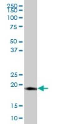 Western Blot: LITAF Antibody [H00009516-B01P] - Analysis of LITAF expression in human placenta.