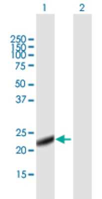 Western Blot: LITAF Antibody [H00009516-B01P] - Analysis of LITAF expression in transfected 293T cell line by LITAF polyclonal antibody.  Lane 1: LITAF transfected lysate(17.71 KDa). Lane 2: Non-transfected lysate.