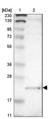 Western Blot: LITAF Antibody [NBP1-83473] - Lane 1: Marker [kDa] 230, 130, 95, 72, 56, 36, 28, 17, 11Lane 2: Human cell line RT-4