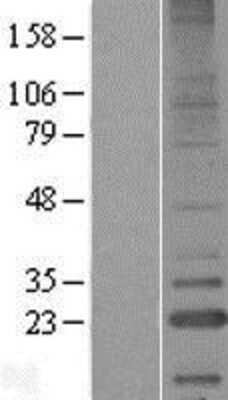 Western Blot: LITAF Overexpression Lysate (Adult Normal) [NBP2-09614] Left-Empty vector transfected control cell lysate (HEK293 cell lysate); Right -Over-expression Lysate for LITAF.