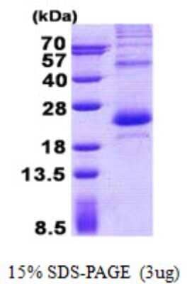 SDS-Page: Recombinant Human LITAF Protein [NBP2-23200]