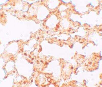 Immunohistochemistry-Paraffin: LIV-1/Zip6 Antibody [NBP1-76503] - Mouse lung tissue with ZIP6 antibody at 5 ug/mL.