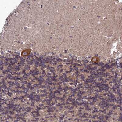 Immunohistochemistry-Paraffin: LIV-1/Zip6 Antibody [NBP2-13337] - Staining of human cerebellum shows strong cytoplasmic positivity in Purkinje cells.