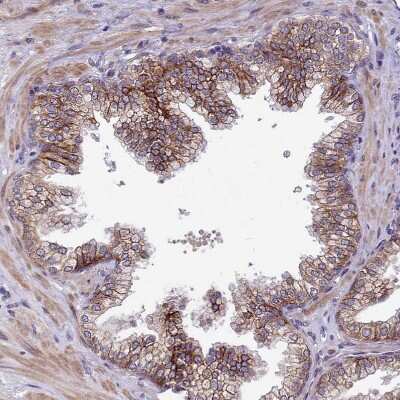 Immunohistochemistry-Paraffin: LIV-1/Zip6 Antibody [NBP2-13337] - Staining of human prostate shows moderate membranous positivity in glandular cells.