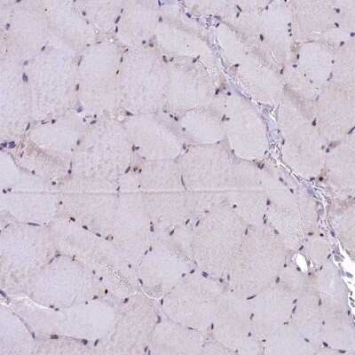 Immunohistochemistry-Paraffin: LIV-1/Zip6 Antibody [NBP2-13337] - Staining of human skeletal muscle shows low positivity in myocytes as expected.