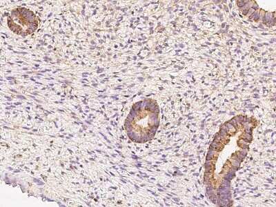 Immunohistochemistry-Paraffin: LIV-1/Zip6 Antibody [NBP2-97843] - Staining of human LIV-1/Zip6 in human corpus uteri with rabbit polyclonal antibody at 1:100 dilution.