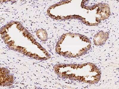 Immunohistochemistry-Paraffin: LIV-1/Zip6 Antibody [NBP2-97843] - Staining of human LIV-1/Zip6 in human prostate with rabbit polyclonal antibody at 1:100 dilution.