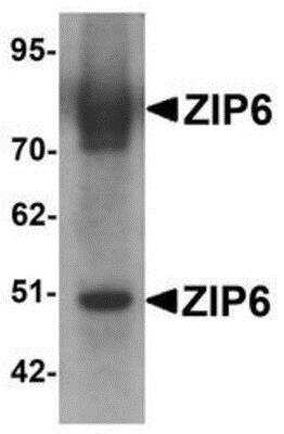 Western Blot: LIV-1/Zip6 Antibody [NBP1-76503] - Mouse lung tissue lysate with LIV-1/Zip6 antibody at 1 ug/mL.