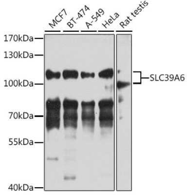 Western Blot: LIV-1/Zip6 Antibody [NBP3-03505] - Analysis of extracts of various cell lines, using LIV-1/Zip6 antibody at 1:1000 dilution. Secondary antibody: HRP Goat Anti-Rabbit IgG (H+L) at 1:10000 dilution. Lysates/proteins: 25ug per lane. Blocking buffer: 3% nonfat dry milk in TBST.