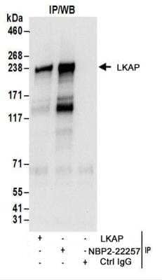 <b>Biological Strategies Validation. </b>Immunoprecipitation: LKAP Antibody [NBP2-22257] - Whole cell lysate (1 mg for IP; 20% of IP loaded) from Jurkat cells.  Antibodies:  NBP2-22257 used for IP at 6 ug/mg lysate.  Limkain b1 was also immunoprecipitated by another rabbit anti-Limkain b1 antibody.  For blotting immunoprecipitated Limkain b1, NBP2-22257 was used at 1 ug/ml.  Detection: Chemiluminescence with an exposure time of 30 seconds.