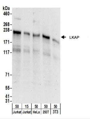 Western Blot: LKAP Antibody [NBP2-22257] - Whole cell lysate from Jurkat (15 and 50 ug), HeLa (50 ug), 293T (50 ug), and mouse NIH3T3 (50 ug) cells.  NBP2-22257used for WB at 0.1 ug/ml.  Detection: Chemiluminescence with an exposure time of 30 seconds.
