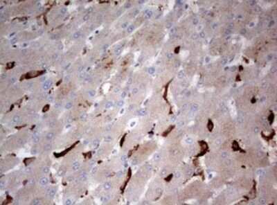 Immunohistochemistry: LKB1/STK11 Antibody (0A3) [NBP2-45460] - Analysis of Human liver tissue. (Heat-induced epitope retrieval by 10mM citric buffer, pH6.0, 120C for 3min)