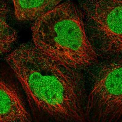 Immunocytochemistry/Immunofluorescence: LKB1/STK11 Antibody [NBP2-56895] - Staining of human cell line A-431 shows localization to nucleoplasm & cytosol. Antibody staining is shown in green.