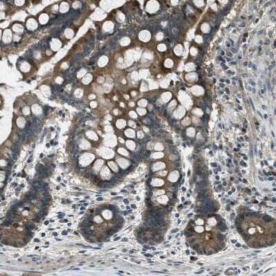 Immunohistochemistry-Paraffin: LKB1/STK11 Antibody [NBP1-87817] - Staining of human colon shows moderate cytoplasmic positivity in glandular cells.