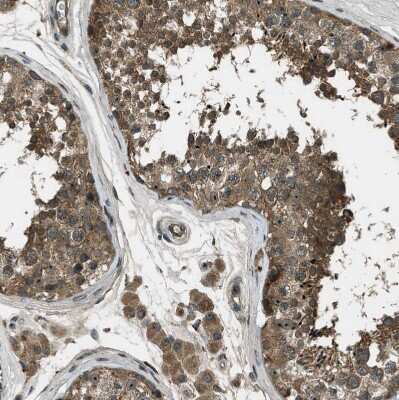 Immunohistochemistry-Paraffin: LKB1/STK11 Antibody [NBP1-87817] - Staining of human testis shows moderate cytoplasmic positivity in cells in seminiferous ducts.