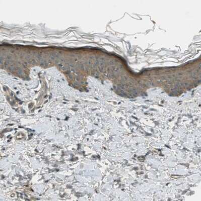 Immunohistochemistry-Paraffin: LKB1/STK11 Antibody [NBP1-87817] - Staining of human skin shows moderate cytoplasmic positivity in squamous epithelial cells.